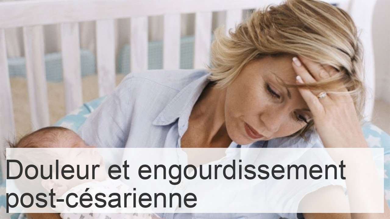 Douleurs postcésarienne causes, durée et gestion de l