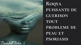 POWERFUL ROQYA HEALING ALL SKIN PROBLEM AND PSORIASIS by Julien Terreau 5,955 views 10 months ago 42 minutes