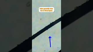 hair under microscope #hair #shorts #microscope #viral
