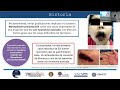 Síndrome de stevens Johnson y diagnósticos diferenciales