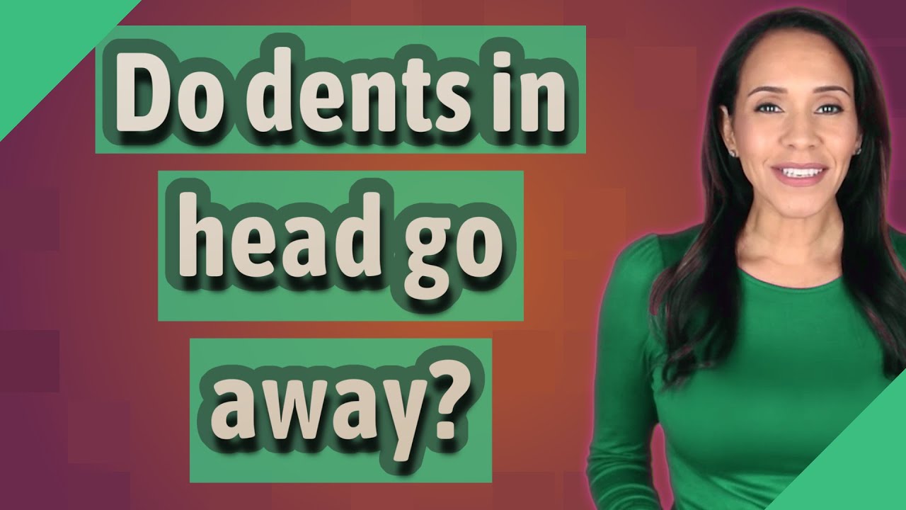 Do Dents In Head Go Away YouTube Do Dents In Head Go Away YouTube