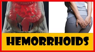 Hemorrhoids:-pathology, Types, Causes, Signs and symptoms, Prevention and treatment