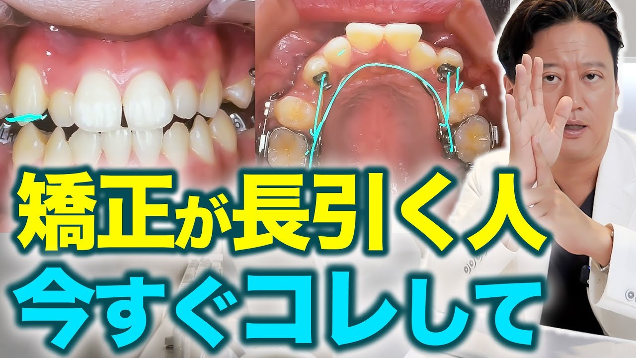 矯正治療を最短で終わらせる方法｜長引く原因と対策を解説