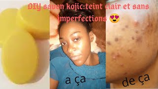 DIY savon kojic pour un teint clair et sans imperfections?