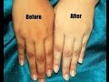 DIY-SKIN WHITENING FOAMING FACIAL BLEACH/HINDI/INDIAN BEAUTY SOLUTIONS