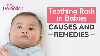 Teething Rash (Drool Rash) in Babies - Causes, Remedies & Prevention screenshot 1