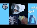 معدات صينية الصنع فائقة لا تعرفها عظام اصطناعية مطبوعة بالتقنية ثلاثية الأبعاد 