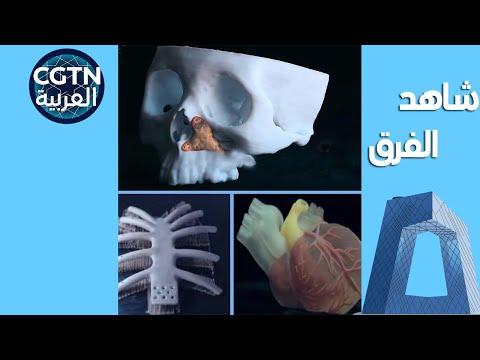 معدات صينية الصنع فائقة لا تعرفها عظام اصطناعية مطبوعة بالتقنية ثلاثية الأبعاد 