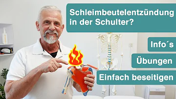 Was kann ich gegen eine Schleimbeutelentzündung in der Schulter machen?