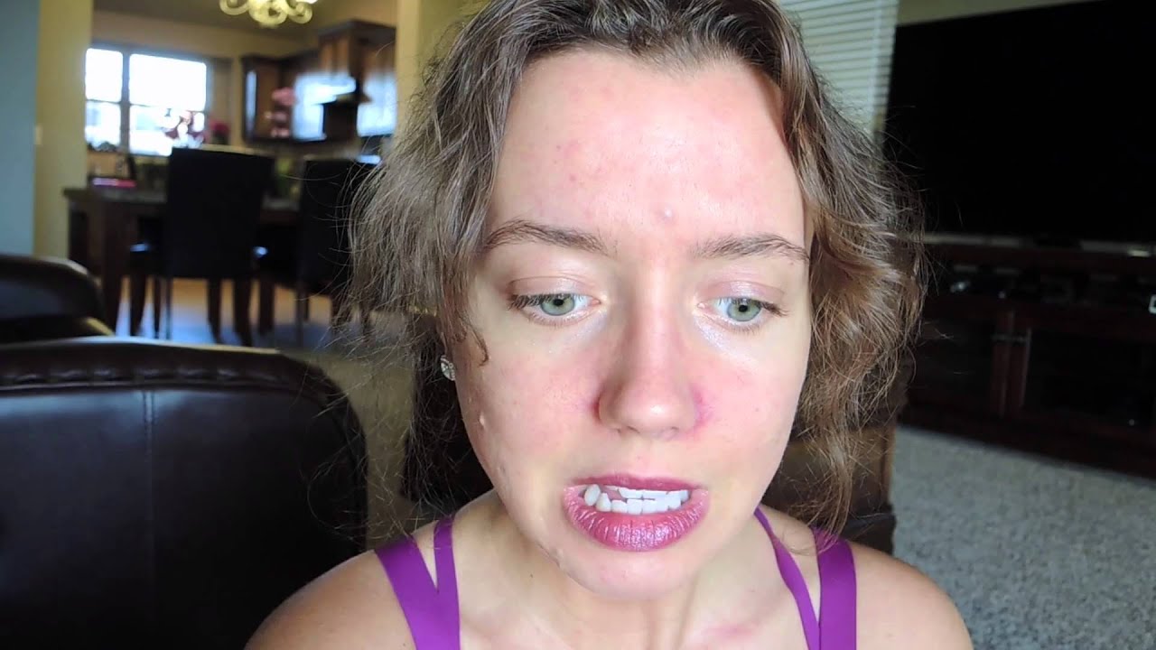 Parasites & Why I Want Them Out! - YouTube