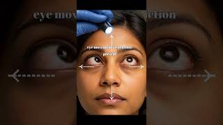 ഇവ തൈറോയ്ഡ് കണ്ണ് രോഗത്തിന്റെ ലക്ഷണങ്ങളാകാം. #ThyroidEyeDisease#doublevision#proptosis#Eye