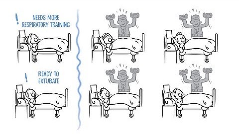 Wean the patient off the ventilator with SmartCare/PS - the automated weaning protocol