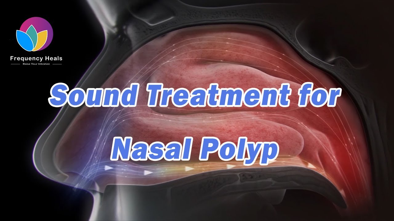 Sound Treatment for Nasal Polyp | Relieve the Pain | Healing Frequency | Relieve Nasal Discomfort