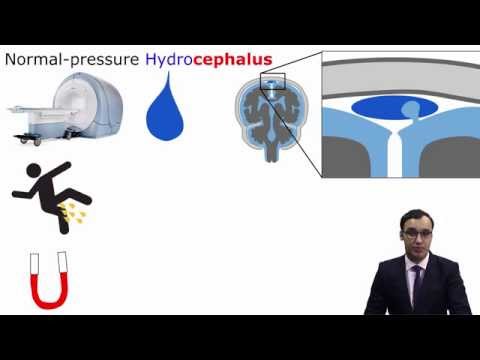 Normal pressure hydrocephalus