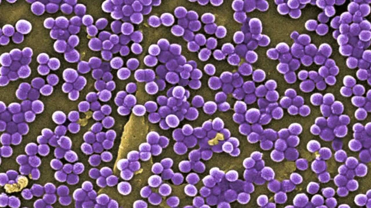 Staphylococcus aureus 5. Стафилококк ауреус под микроскопом. Золотистый стафилококк микроскопия. Staphylococcus epidermidis под микроскопом. Staphylococcus saprophyticus под микроскопом.