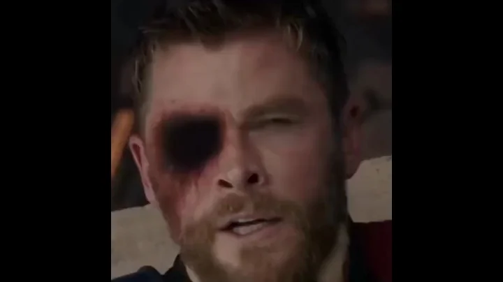 People Who Gained Real Superpowers After An Accident #shorts #trending #viral