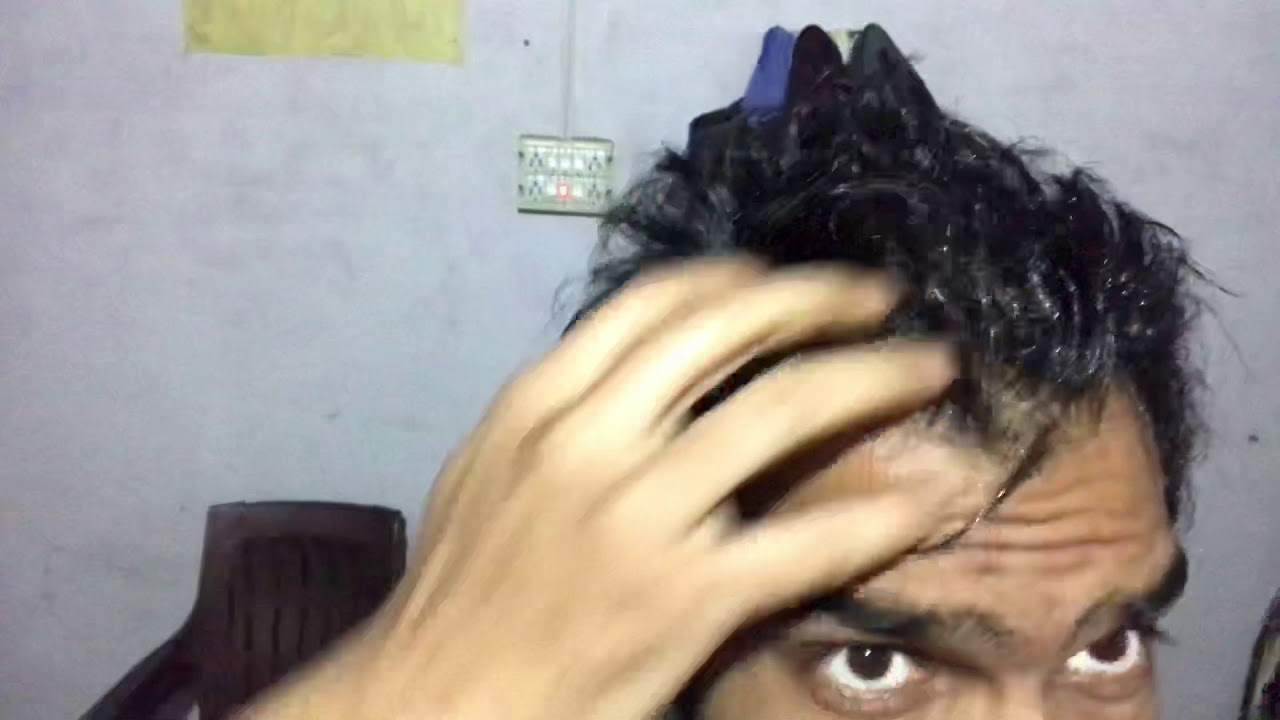To Much Hair Fall YouTube