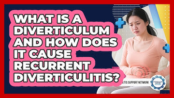 What Is A Diverticulum And How Does It Cause Recurrent Diverticulitis?