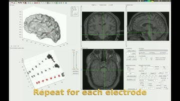 iElectrodes - Localising intracranial depth electrodes tutorial