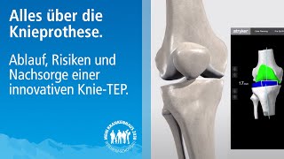 Knie-TEP (Knieprothese):  Künstliches Kniegelenk | MAKO Roboter Assistenzsystem reduziert Risiken