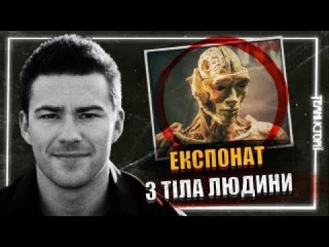 Справа Кріса Тодда Еріка. Темна Версія
