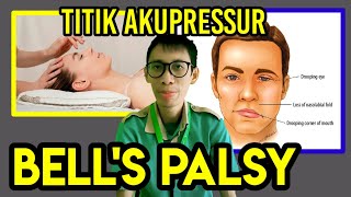 TITIK AKUPRESSUR BELLS PALSY (LEMAH OTOT WAJAH)