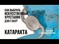 Что такое ИОЛ? Как выбрать искусственный хрусталик для глаз? Лечение катаракты