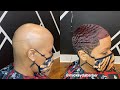 How I help some of my clients dealing with alopecia