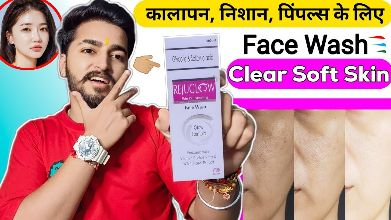 Face Wash For Clear Soft Skin Oily, Acne, Blackheads, Pimple Prone