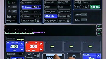 4E - Pacing Protocols - MultiSx 1: VT Study Basic