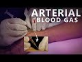 Arterial Blood Gas (ABG) Procedure - OSCE Demonstration