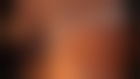 Laparoscopic left nephroureterectomy (with no editting)