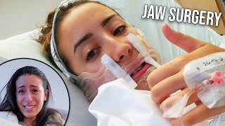 MY JAW SURGERY EXPERIENCE | Before and After