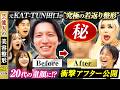 【完結編】元KAT-TUN田口淳之介が"究極の若返り整形"で20代の童顔に!? 衝撃アフター公開！【芸能人の美容整形SP | 元KAT-TUN田口淳之介 | After】