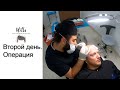 Операция по пересадке волос . hair transplantation FUE Sapphire