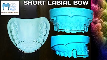Short Labial Bow | how to make Labial Bow | fabrication | Orthodontics | close gap between teeth