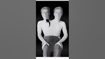 Edward Mordrake – The Man with Two Faces 😱 | True Horror Story in Urdu" #EdwardMordrake  #TrueStory