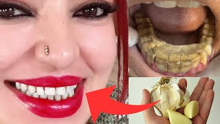 Download Lagu والله ثم والله لن تحتاجي الذهاب لطبيب الأسنان تبييض ألأسنان وإسقاط الجير سيسقط لوحده في1دقيقة فقط MP3