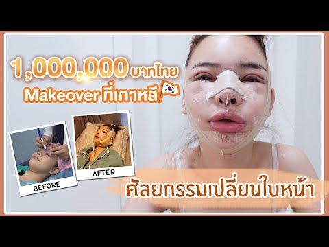 ศัลยกรรมMakeoverที่เกาหลี🇰🇷 1 ล้านบาทไทย‼️