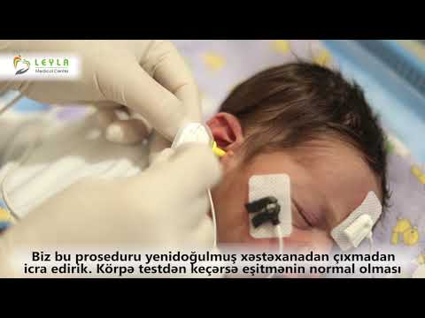 Leyla Medical Center  -  Eşitmə skrininq Testi