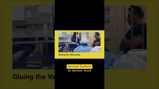 varicocele non-surgical treatment by interventionalradiology