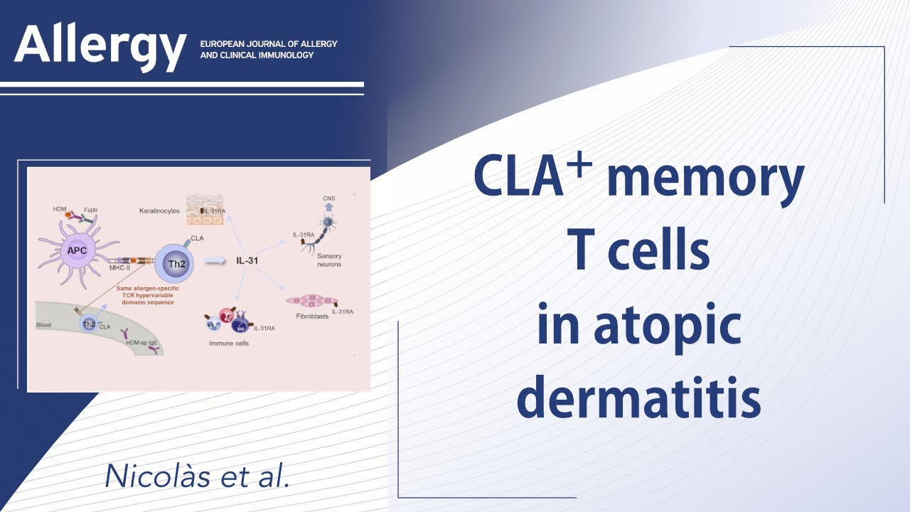 CLA+ memory T cells in atopic dermatitis. - YouTube