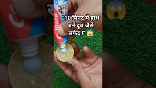 Instant Fair Hands in 10 Minutes | Salon Like Manicure At Home | Remove Hand Tan & Dirt #shorts