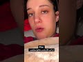 ترامب صار منتصر ثمانين مرة باليوم