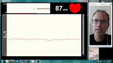 Cảm Biến Nhịp Tim  Pulsesensor Arduino_Banlinhkien.Vn
