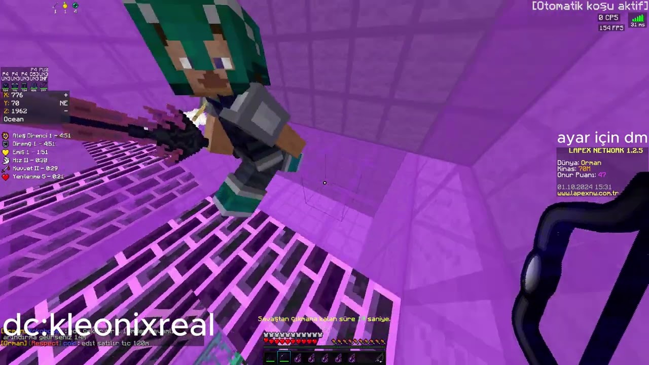 35X EDİT KESTİM | LAPEX NETWORK