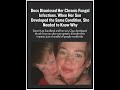 Doctors Couldn’t Stop Her Painful Fungal Infection — Until Her Son Started Showing the Same Symptoms