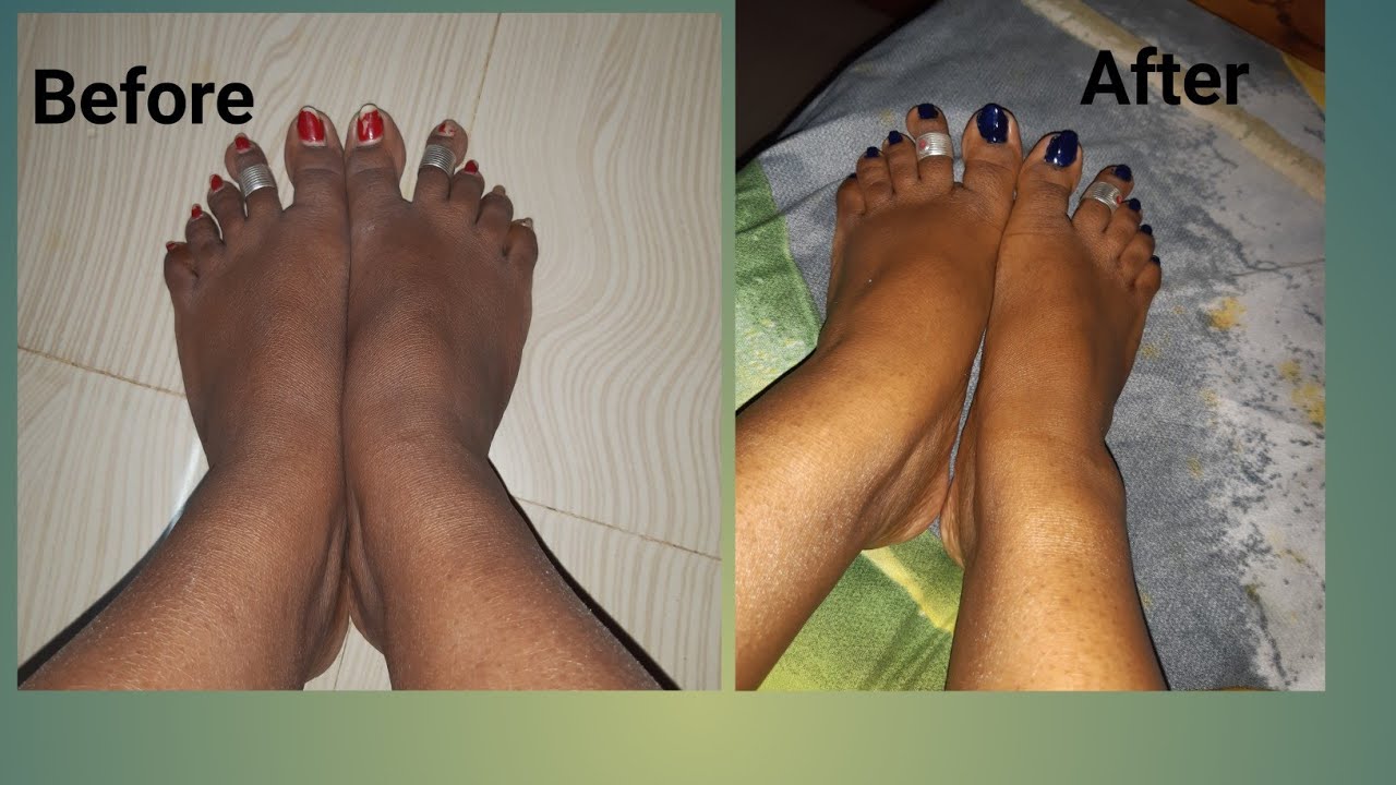 Pedicure at home in tamil/ how to do pedicure at home Naturally remove
