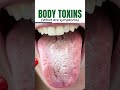 Symptoms Of Body Toxins #ayushakti #drsmitapankajnaram #toxins