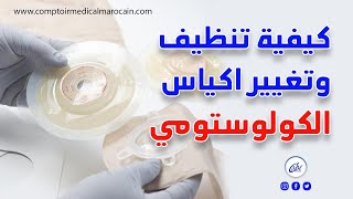 كيفية تنظيف وتغيير اكياس الكولوستومي||CHANGER POCHE DE COLOSTOMIE